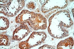 MYO16 Rabbit anti-Human, Mouse, Polyclonal, Proteintech:Antibodies:Primary