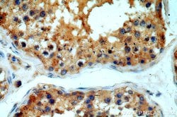 MYO16 Rabbit anti-Human, Mouse, Polyclonal, Proteintech:Antibodies:Primary