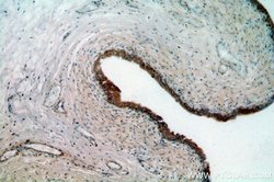 MYO16 Rabbit anti-Human, Mouse, Polyclonal, Proteintech:Antibodies:Primary