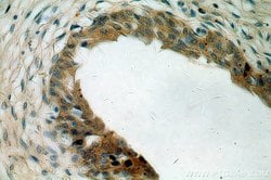 MYO16 Rabbit anti-Human, Mouse, Polyclonal, Proteintech:Antibodies:Primary