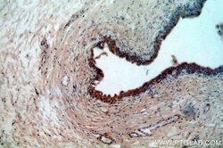 MYO16 Rabbit anti-Human, Mouse, Polyclonal, Proteintech:Antibodies:Primary