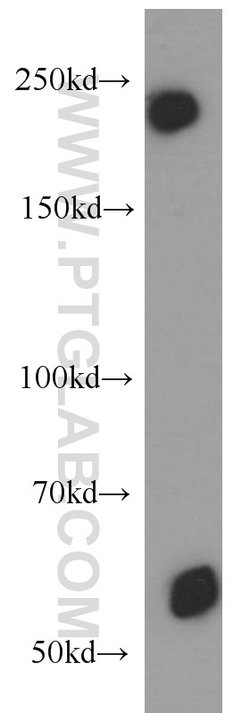 MYO16 Rabbit anti-Human, Mouse, Polyclonal, Proteintech:Antibodies:Primary