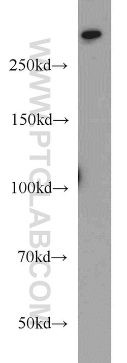 1A6/DRIM Rabbit anti-Human, Mouse, Rat, Polyclonal, Proteintech:Antibodies:Primary