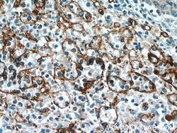 CD36 Rabbit anti-Hamster, Human, Mouse, Polyclonal, Proteintech:Antibodies:Primary