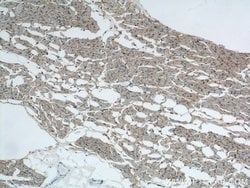 CD36 Rabbit anti-Hamster, Human, Mouse, Polyclonal, Proteintech:Antibodies:Primary