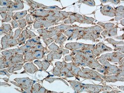 CD36 Rabbit anti-Hamster, Human, Mouse, Polyclonal, Proteintech:Antibodies:Primary