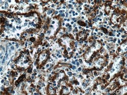 CD36 Rabbit anti-Hamster, Human, Mouse, Polyclonal, Proteintech:Antibodies:Primary