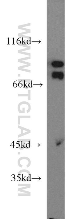 CD36 Rabbit anti-Hamster, Human, Mouse, Polyclonal, Proteintech:Antibodies:Primary