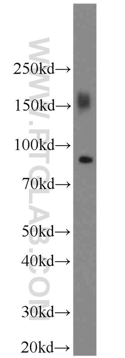 CD36 Rabbit anti-Hamster, Human, Mouse, Polyclonal, Proteintech:Antibodies:Primary