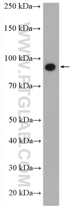 CD36 Rabbit anti-Hamster, Human, Mouse, Polyclonal, Proteintech:Antibodies:Primary