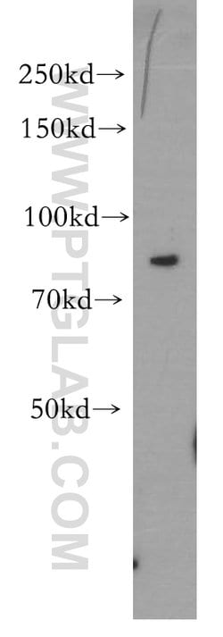 CD36 Rabbit anti-Hamster, Human, Mouse, Polyclonal, Proteintech:Antibodies:Primary