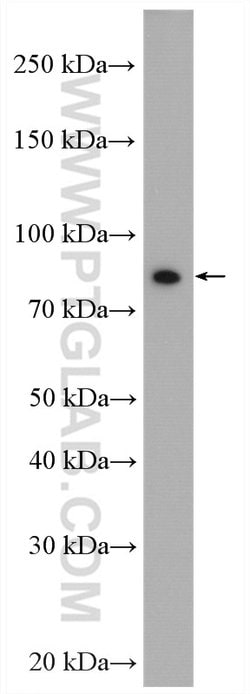 CD36 Rabbit anti-Hamster, Human, Mouse, Polyclonal, Proteintech:Antibodies:Primary