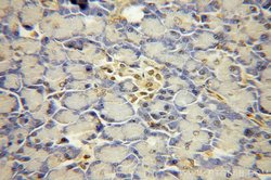USP32 Rabbit anti-Human, Mouse, Polyclonal, Proteintech:Antibodies:Primary