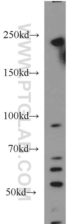 USP32 Rabbit anti-Human, Mouse, Polyclonal, Proteintech:Antibodies:Primary