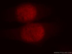 UBR2 Rabbit anti-Human, Mouse, Polyclonal, Proteintech:Antibodies:Primary