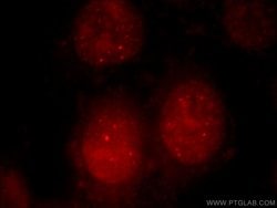 UBR2 Rabbit anti-Human, Mouse, Polyclonal, Proteintech:Antibodies:Primary