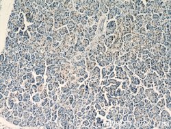UBR2 Rabbit anti-Human, Mouse, Polyclonal, Proteintech:Antibodies:Primary