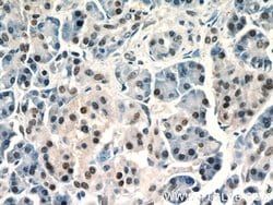 UBR2 Rabbit anti-Human, Mouse, Polyclonal, Proteintech:Antibodies:Primary