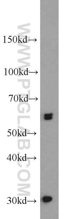 UBR2 Rabbit anti-Human, Mouse, Polyclonal, Proteintech:Antibodies:Primary