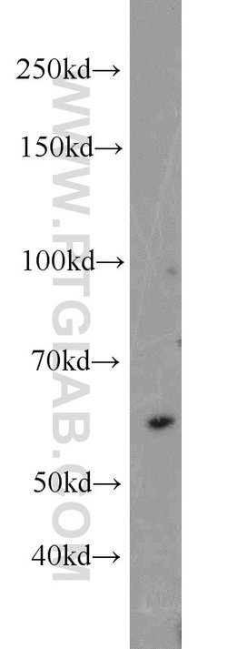 UBR2 Rabbit anti-Human, Mouse, Polyclonal, Proteintech:Antibodies:Primary