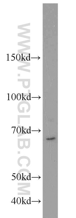 UBR2 Rabbit anti-Human, Mouse, Polyclonal, Proteintech:Antibodies:Primary