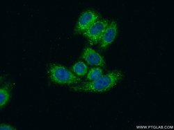 MRPS17 Rabbit anti-Human, Mouse, Rat, Polyclonal, Proteintech 150 &mu;L;