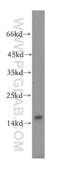 MRPS17 Rabbit anti-Human, Mouse, Rat, Polyclonal, Proteintech 150 &mu;L;