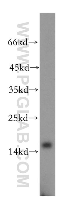 MRPS17 Rabbit anti-Human, Mouse, Rat, Polyclonal, Proteintech 150 &mu;L;