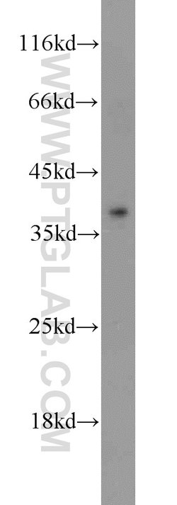 ADH1C Rabbit anti-Human, Mouse, Rat, Polyclonal, Proteintech 150 &mu;L;