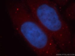 ADH1C Rabbit anti-Human, Mouse, Rat, Polyclonal, Proteintech 150 &mu;L;