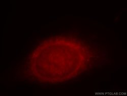 SOX13 Rabbit anti-Human, Mouse, Rat, Polyclonal, Proteintech 20 &mu;L | Buy Online | Proteintech | Fisher Scientific