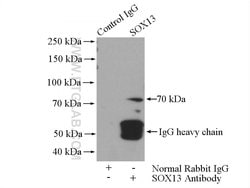 SOX13 Rabbit anti-Human, Mouse, Rat, Polyclonal, Proteintech 20 &mu;L | Buy Online | Proteintech | Fisher Scientific