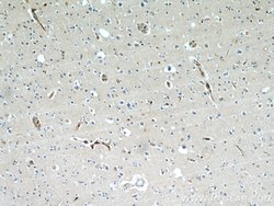 BBS7 Rabbit anti-Human, Mouse, Polyclonal, Proteintech:Antibodies:Primary