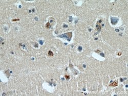 BBS7 Rabbit anti-Human, Mouse, Polyclonal, Proteintech:Antibodies:Primary