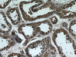 BBS7 Rabbit anti-Human, Mouse, Polyclonal, Proteintech:Antibodies:Primary