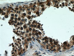 BBS7 Rabbit anti-Human, Mouse, Polyclonal, Proteintech:Antibodies:Primary