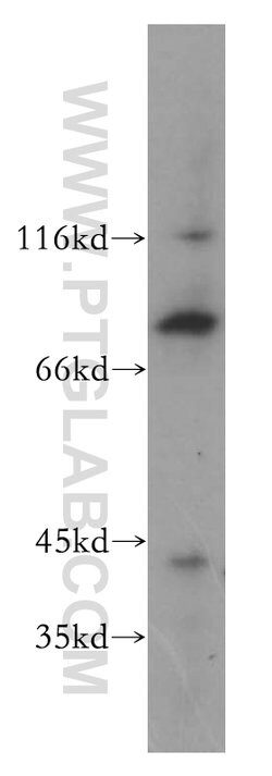 BBS7 Rabbit anti-Human, Mouse, Polyclonal, Proteintech:Antibodies:Primary