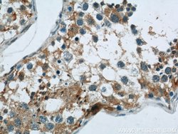 PAOX Rabbit anti-Human, Mouse, Rat, Polyclonal, Proteintech 150 &mu;L;
