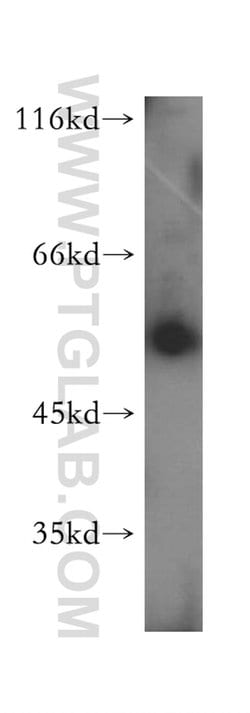 PAOX Rabbit anti-Human, Mouse, Rat, Polyclonal, Proteintech 150 &mu;L;