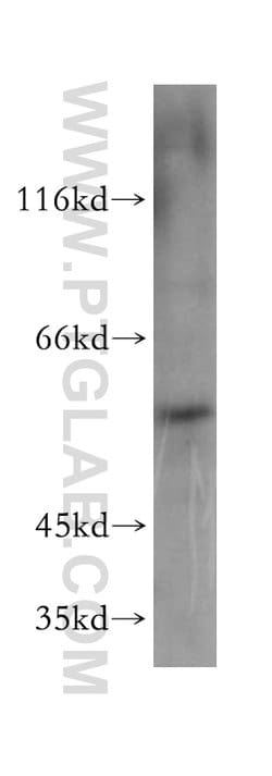 PAOX Rabbit anti-Human, Mouse, Rat, Polyclonal, Proteintech 150 &mu;L;