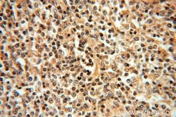 IRF8 Rabbit anti-Human, Mouse, Rat, Polyclonal, Proteintech:Antibodies:Primary