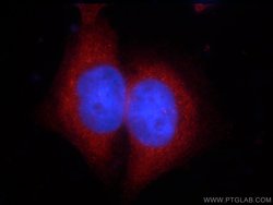 ZCCHC11 Rabbit anti-Human, Mouse, Polyclonal, Proteintech 150 &mu;L; Unconjugated:Antibodies,
