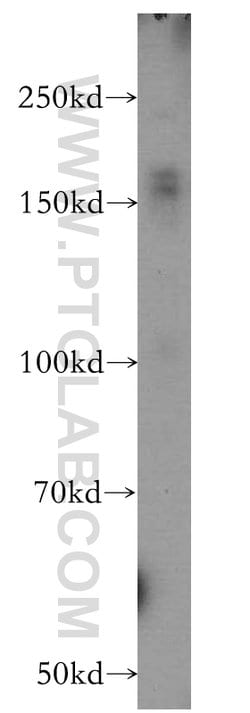 ZCCHC11 Rabbit anti-Human, Mouse, Polyclonal, Proteintech 150 &mu;L; Unconjugated:Antibodies,