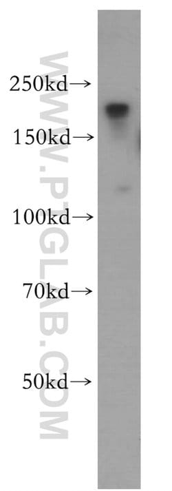 ZCCHC11 Rabbit anti-Human, Mouse, Polyclonal, Proteintech 150 &mu;L; Unconjugated:Antibodies,