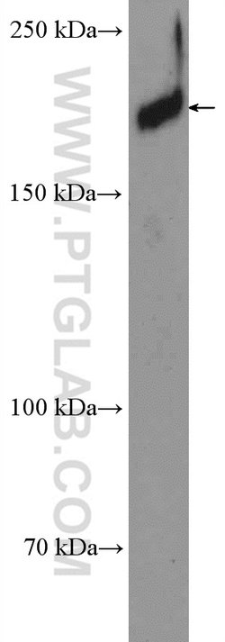 ZCCHC11 Rabbit anti-Human, Mouse, Polyclonal, Proteintech 150 &mu;L; Unconjugated:Antibodies,