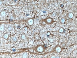 nNOS Rabbit anti-Human, Mouse, Polyclonal, Proteintech 150 &mu;L; Unconjugated:Antibodies,