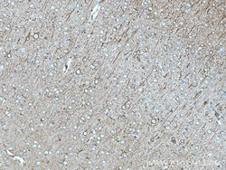 nNOS Rabbit anti-Human, Mouse, Polyclonal, Proteintech 150 &mu;L; Unconjugated:Antibodies,