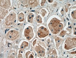 EGFR Rabbit anti-Human, Rat, Polyclonal, Proteintech 150 &mu;L; Unconjugated:Antibodies,