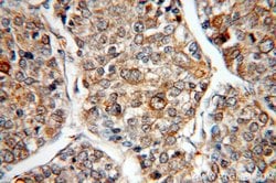 HAUS3 Rabbit anti-Human, Mouse, Rat, Polyclonal, Proteintech 150 μL;