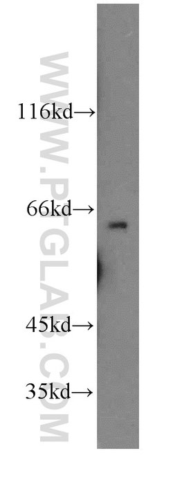 HAUS3 Rabbit anti-Human, Mouse, Rat, Polyclonal, Proteintech 150 μL;